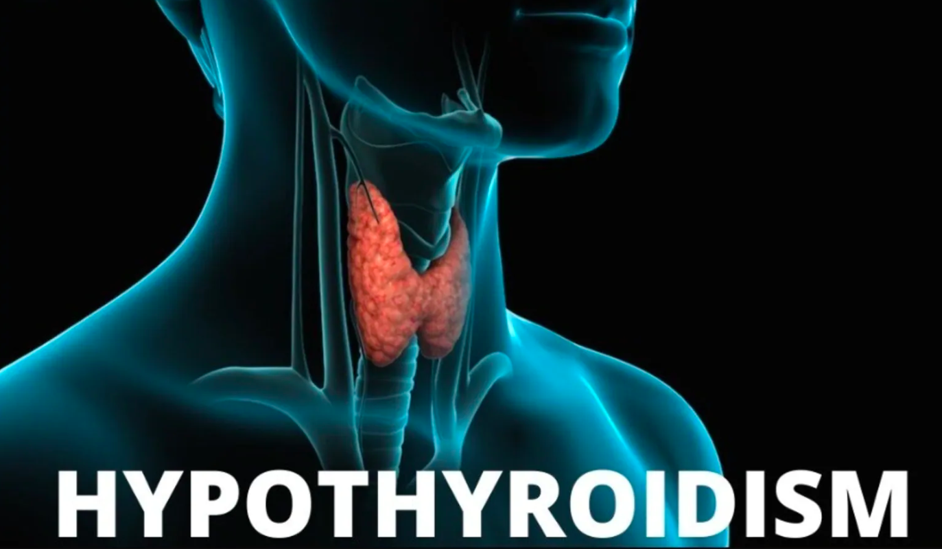 Underactive Thyroid: How to manage Hypothyroidism?