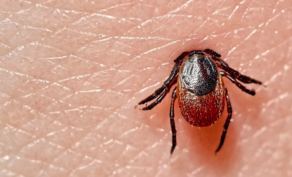 The Lyme Disease: Its Symptoms, Causes, Prevention and more